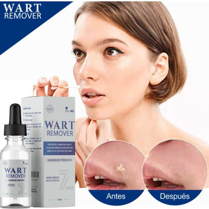 Wart Remover | Tratamiento contra Verrugas